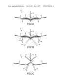 GRIPPER PUSHER MECHANISM FOR TISSUE APPOSITION SYSTEMS diagram and image