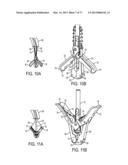 GRIPPER PUSHER MECHANISM FOR TISSUE APPOSITION SYSTEMS diagram and image