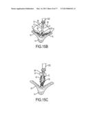 GRIPPER PUSHER MECHANISM FOR TISSUE APPOSITION SYSTEMS diagram and image