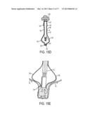 GRIPPER PUSHER MECHANISM FOR TISSUE APPOSITION SYSTEMS diagram and image