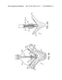 GRIPPER PUSHER MECHANISM FOR TISSUE APPOSITION SYSTEMS diagram and image