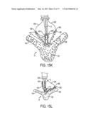 GRIPPER PUSHER MECHANISM FOR TISSUE APPOSITION SYSTEMS diagram and image