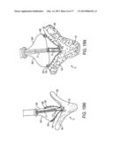 GRIPPER PUSHER MECHANISM FOR TISSUE APPOSITION SYSTEMS diagram and image