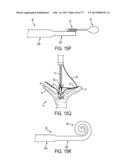 GRIPPER PUSHER MECHANISM FOR TISSUE APPOSITION SYSTEMS diagram and image