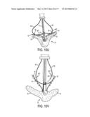 GRIPPER PUSHER MECHANISM FOR TISSUE APPOSITION SYSTEMS diagram and image