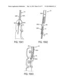 GRIPPER PUSHER MECHANISM FOR TISSUE APPOSITION SYSTEMS diagram and image