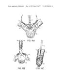 GRIPPER PUSHER MECHANISM FOR TISSUE APPOSITION SYSTEMS diagram and image