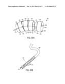 GRIPPER PUSHER MECHANISM FOR TISSUE APPOSITION SYSTEMS diagram and image