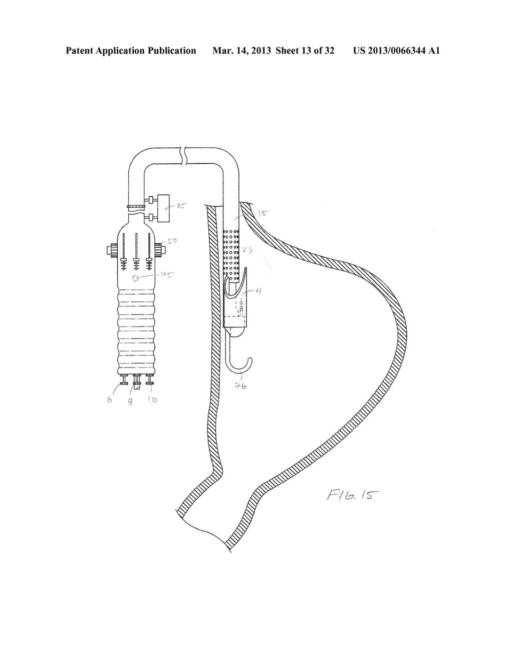 METHODS AND DEVICES FOR MANIPULATING AND FASTENING TISSUE - diagram, schematic, and image 14