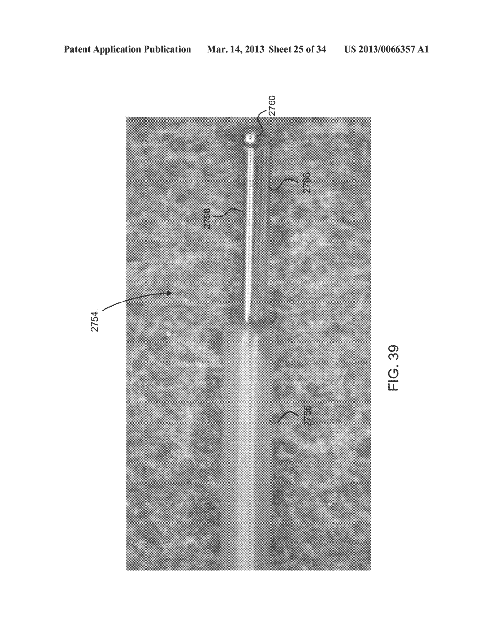 DEVICES AND METHODS FOR THE TREATMENT OF VASCULAR DEFECTS - diagram, schematic, and image 26