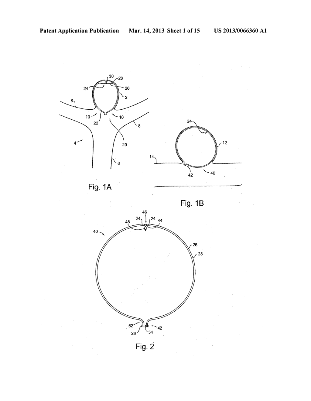 Braid-Ball Embolic Devices - diagram, schematic, and image 02