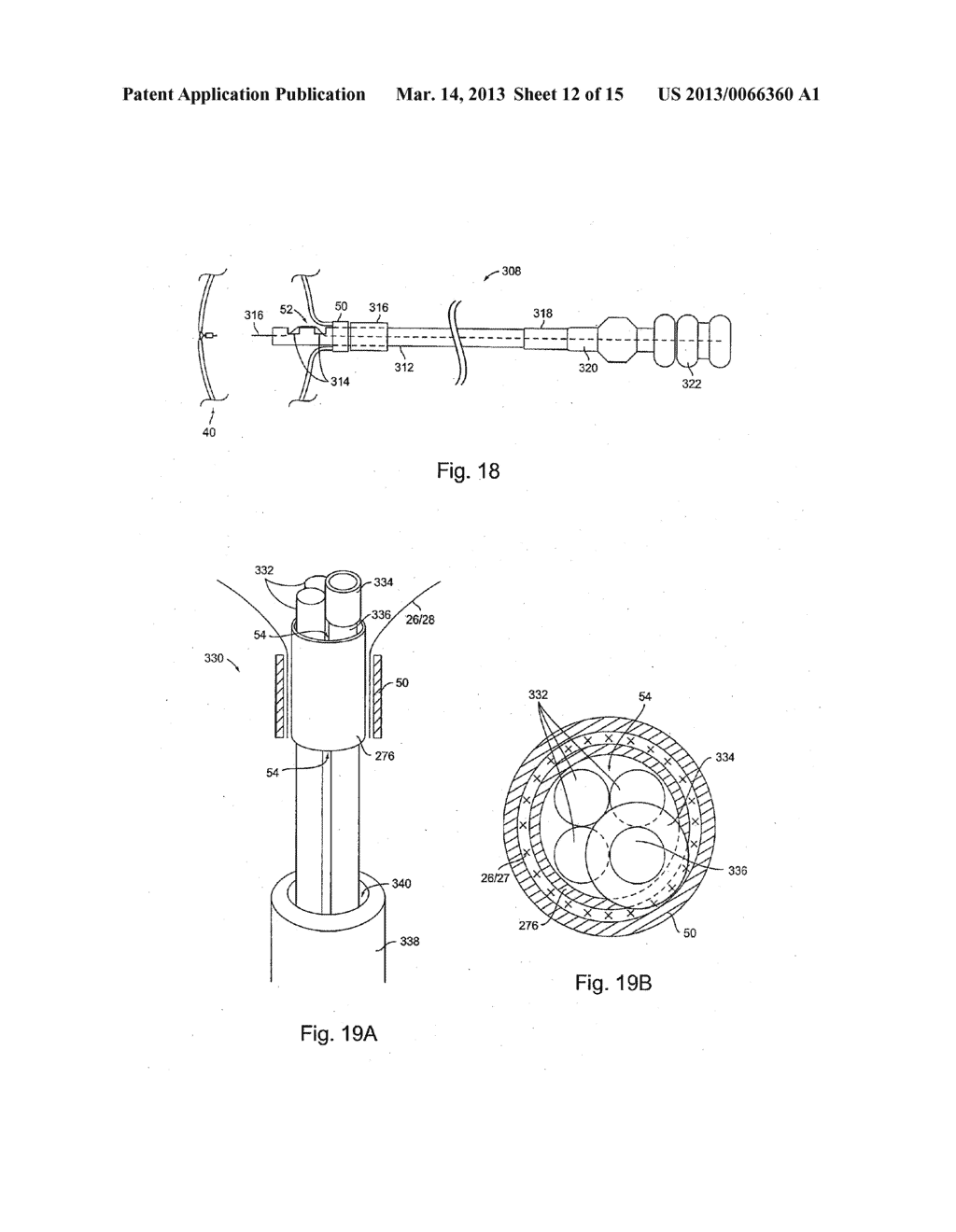 Braid-Ball Embolic Devices - diagram, schematic, and image 13