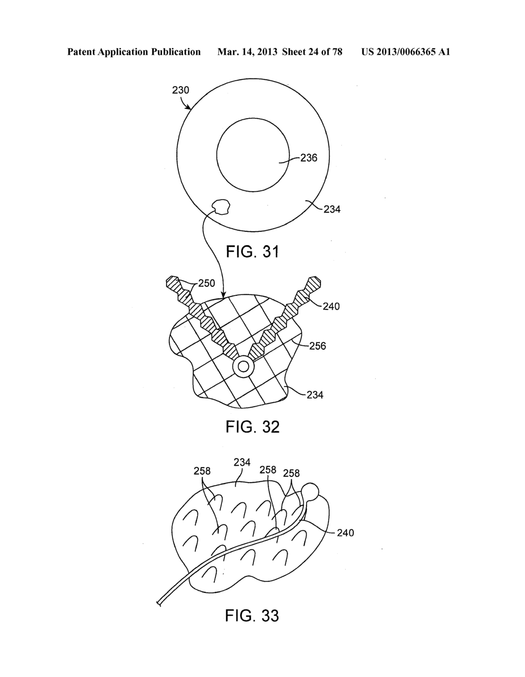 RAPID CLOSING SURGICAL CLOSURE DEVICE - diagram, schematic, and image 25