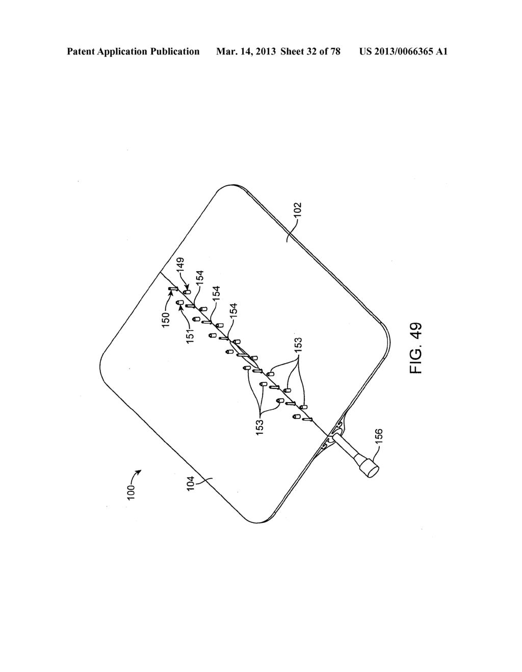 RAPID CLOSING SURGICAL CLOSURE DEVICE - diagram, schematic, and image 33