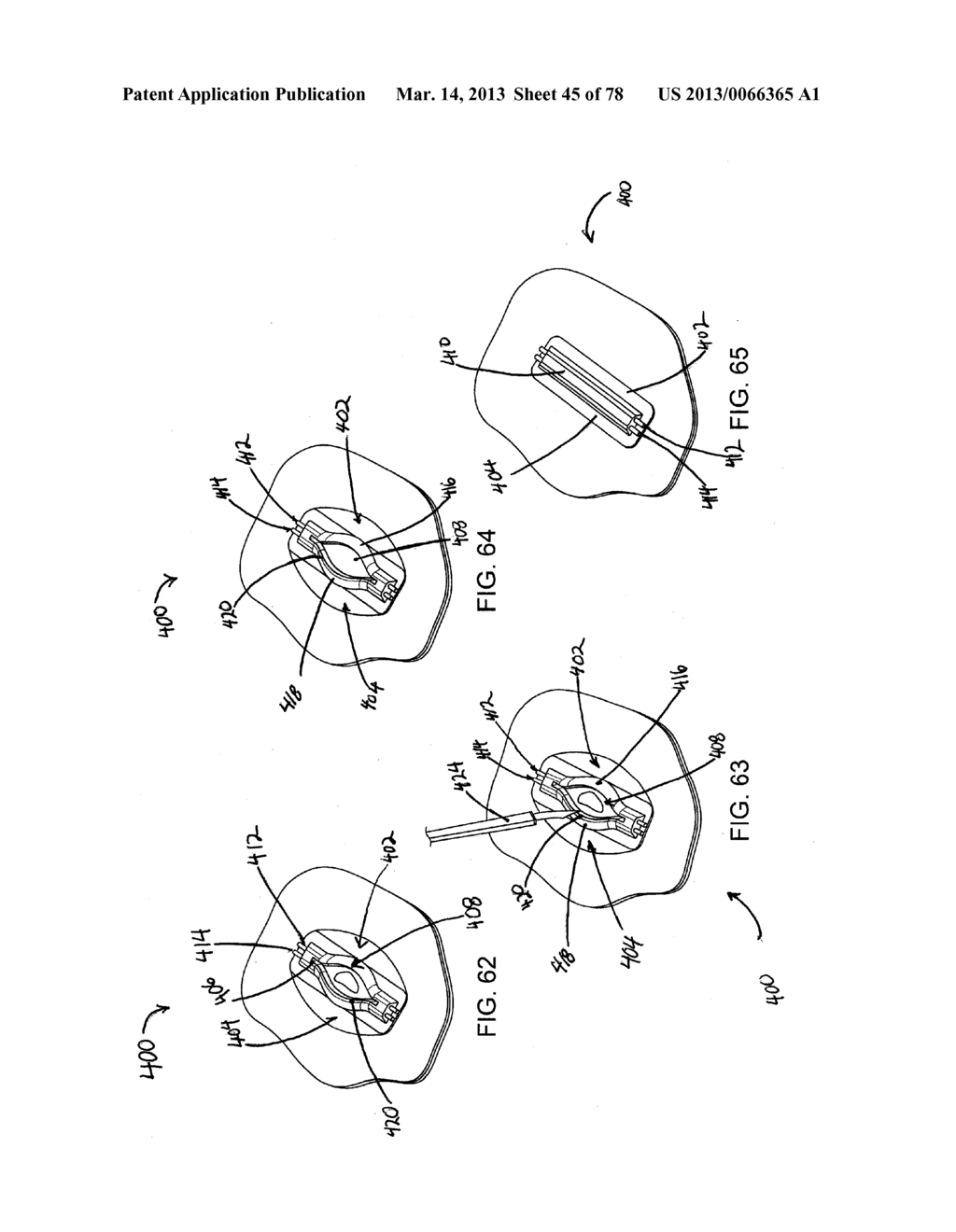 RAPID CLOSING SURGICAL CLOSURE DEVICE - diagram, schematic, and image 46