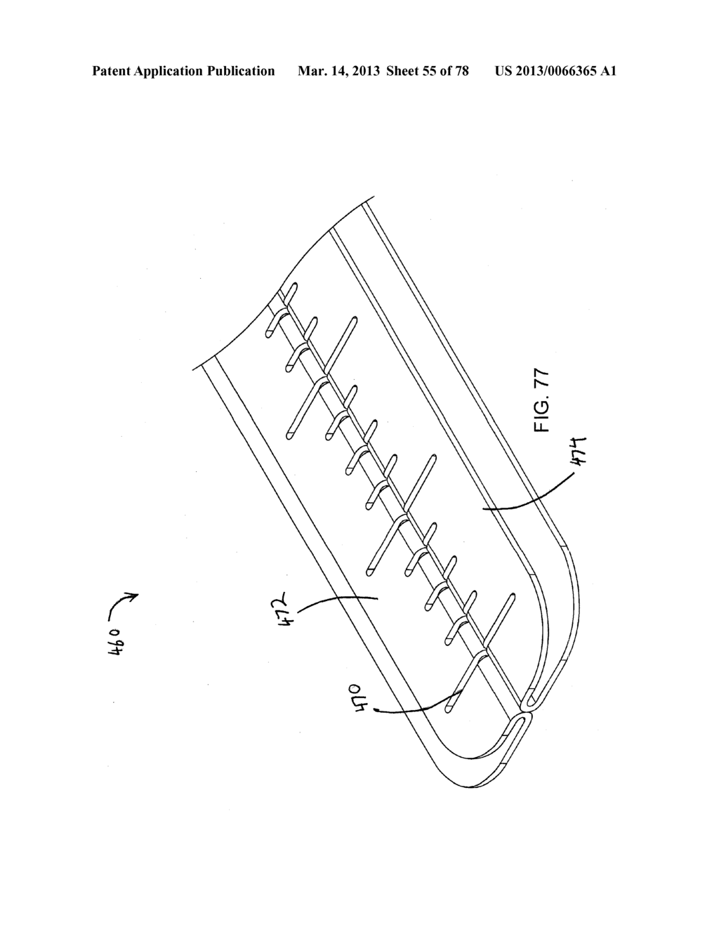 RAPID CLOSING SURGICAL CLOSURE DEVICE - diagram, schematic, and image 56