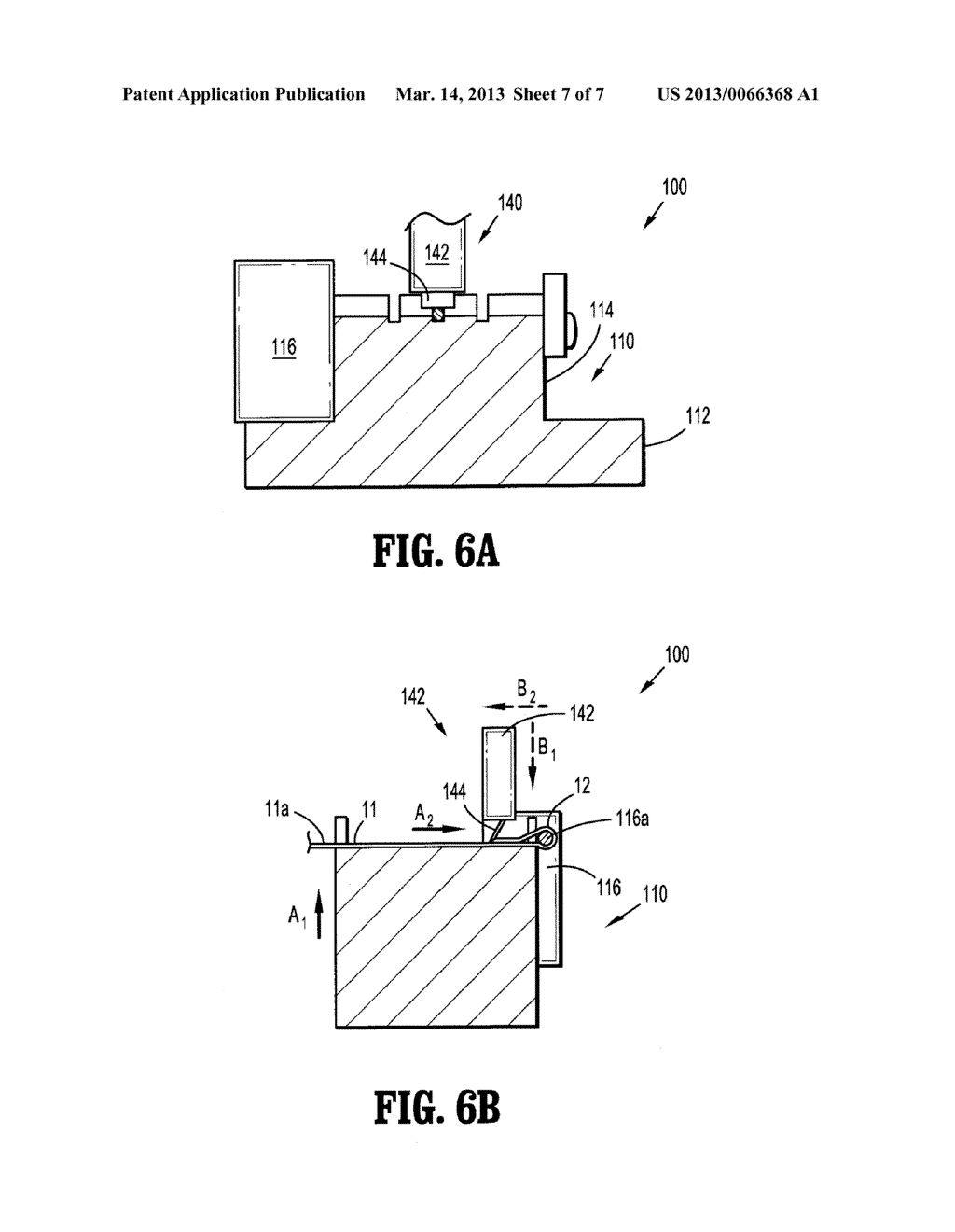 Looped Suture - diagram, schematic, and image 08