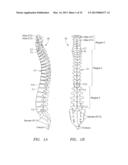 Systems, Devices and Methods for the Correction of Spinal Deformities diagram and image