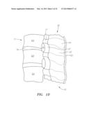 Systems, Devices and Methods for the Correction of Spinal Deformities diagram and image