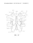 Systems, Devices and Methods for the Correction of Spinal Deformities diagram and image