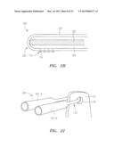 Systems, Devices and Methods for the Correction of Spinal Deformities diagram and image