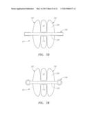 Systems, Devices and Methods for the Correction of Spinal Deformities diagram and image