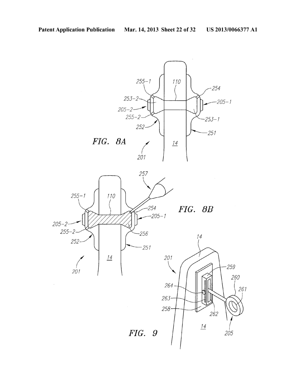 Systems, Devices and Methods for the Correction of Spinal Deformities - diagram, schematic, and image 23