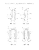 Systems, Devices and Methods for the Correction of Spinal Deformities diagram and image