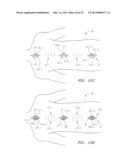 Systems, Devices and Methods for the Correction of Spinal Deformities diagram and image