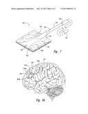 TECHNIQUES FOR SELECTING SIGNAL DELIVERY SITES AND OTHER PARAMETERS FOR     TREATING DEPRESSION AND OTHER NEUROLOGICAL DISORDERS, AND ASSOCIATED     SYSTEMS AND METHODS diagram and image