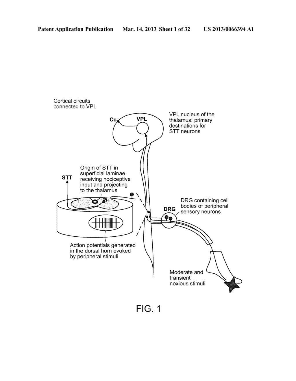 Pain Management - diagram, schematic, and image 02