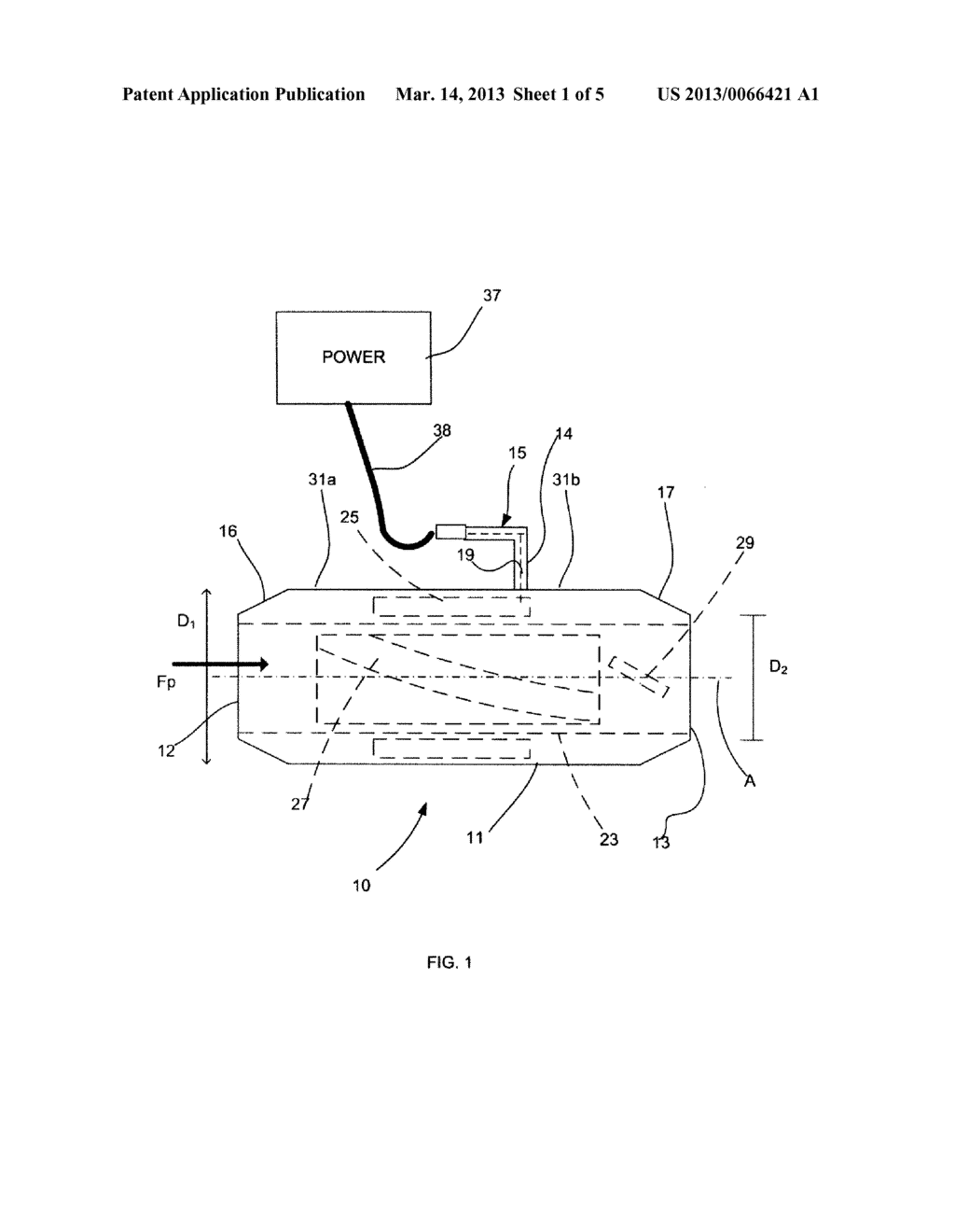 INTRAVASCULAR BLOOD PUMP AND METHOD OF IMPLANTATION - diagram, schematic, and image 02