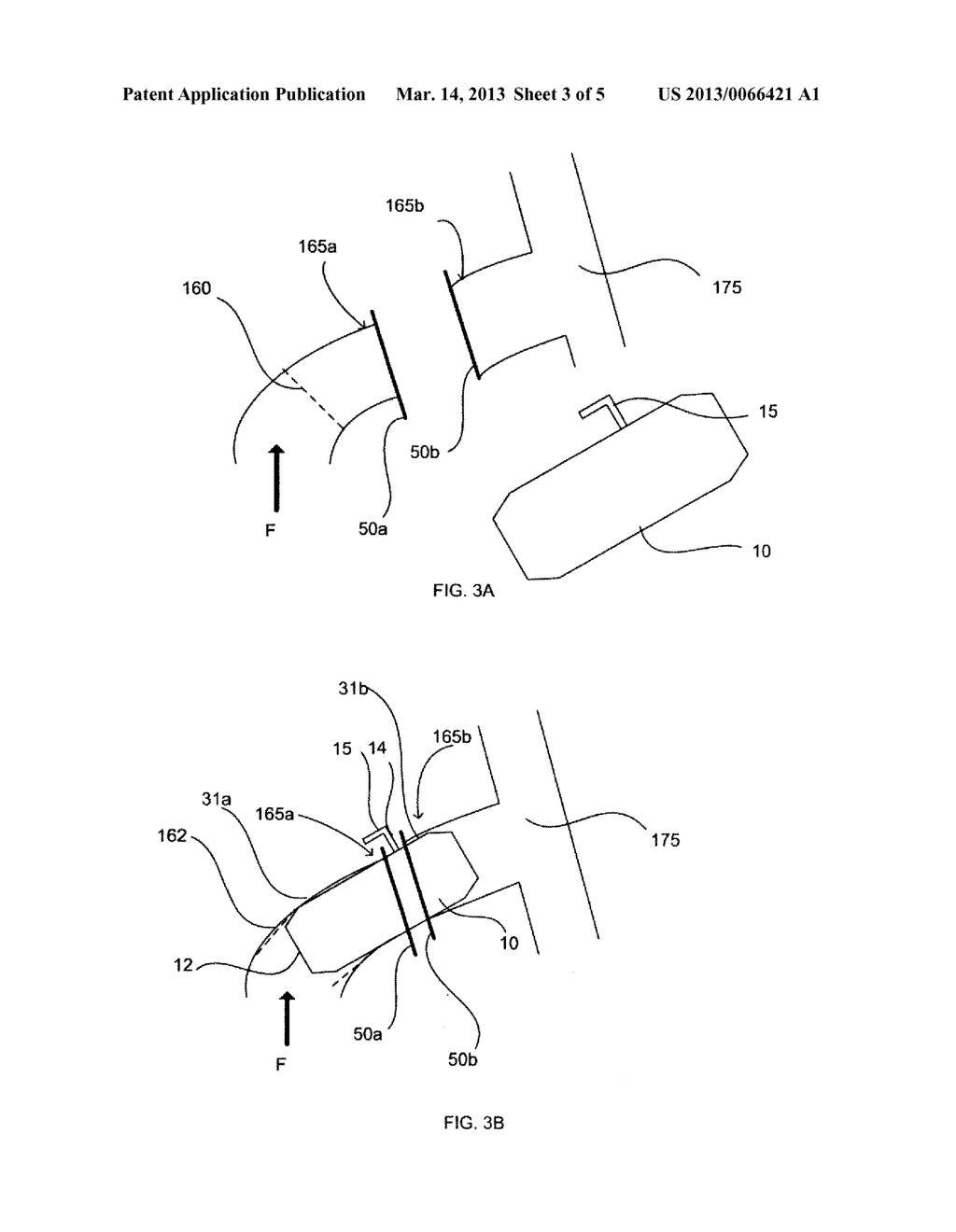 INTRAVASCULAR BLOOD PUMP AND METHOD OF IMPLANTATION - diagram, schematic, and image 04