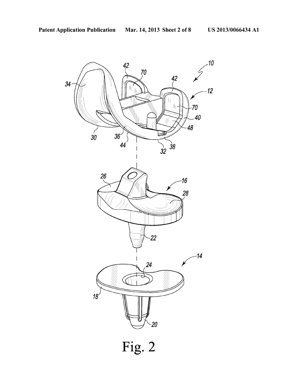 FEMORAL COMPONENT OF A KNEE PROSTHESIS HAVING AN ANGLED CEMENT POCKET - diagram, schematic, and image 03