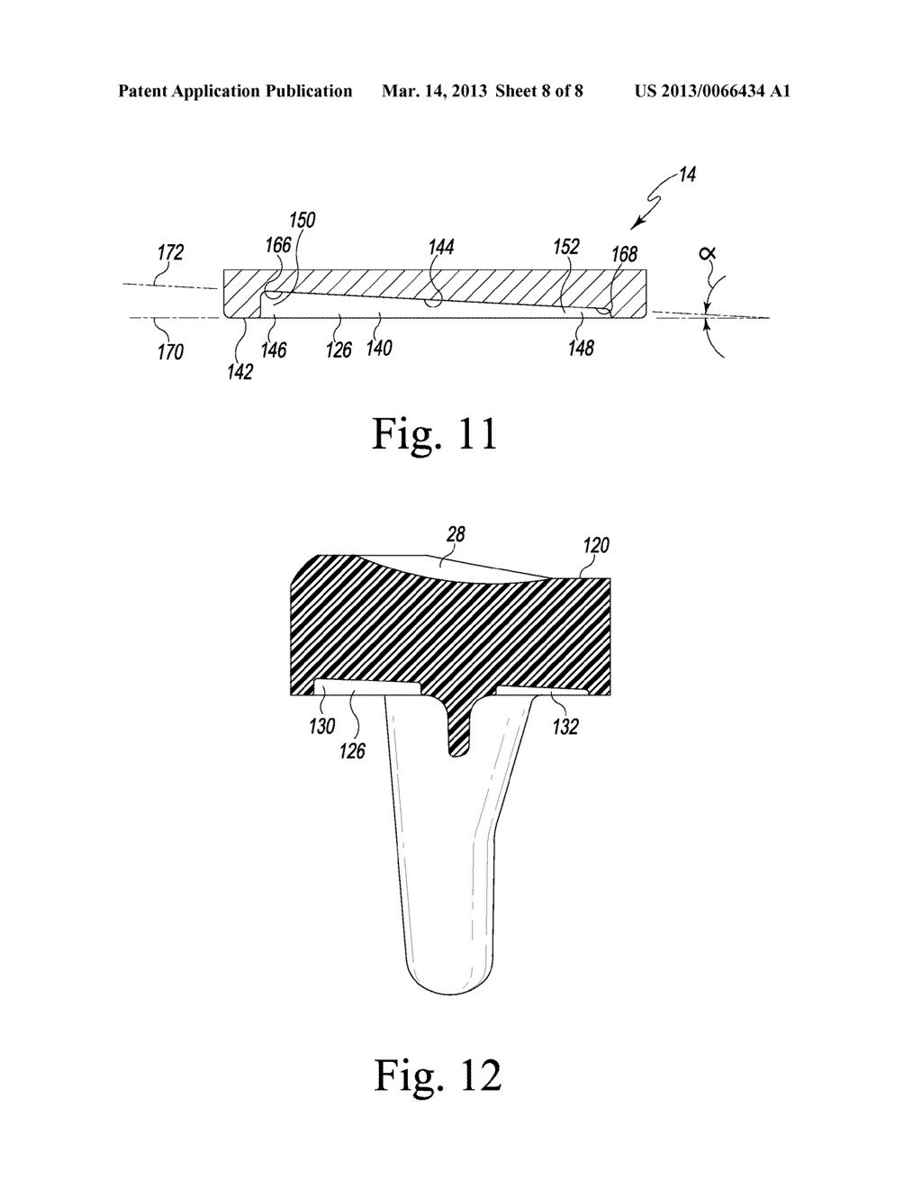 FEMORAL COMPONENT OF A KNEE PROSTHESIS HAVING AN ANGLED CEMENT POCKET - diagram, schematic, and image 09