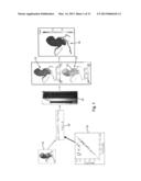 METHOD AND SYSTEM FOR PATIENT-SPECIFIC MODELING OF BLOOD FLOW diagram and image