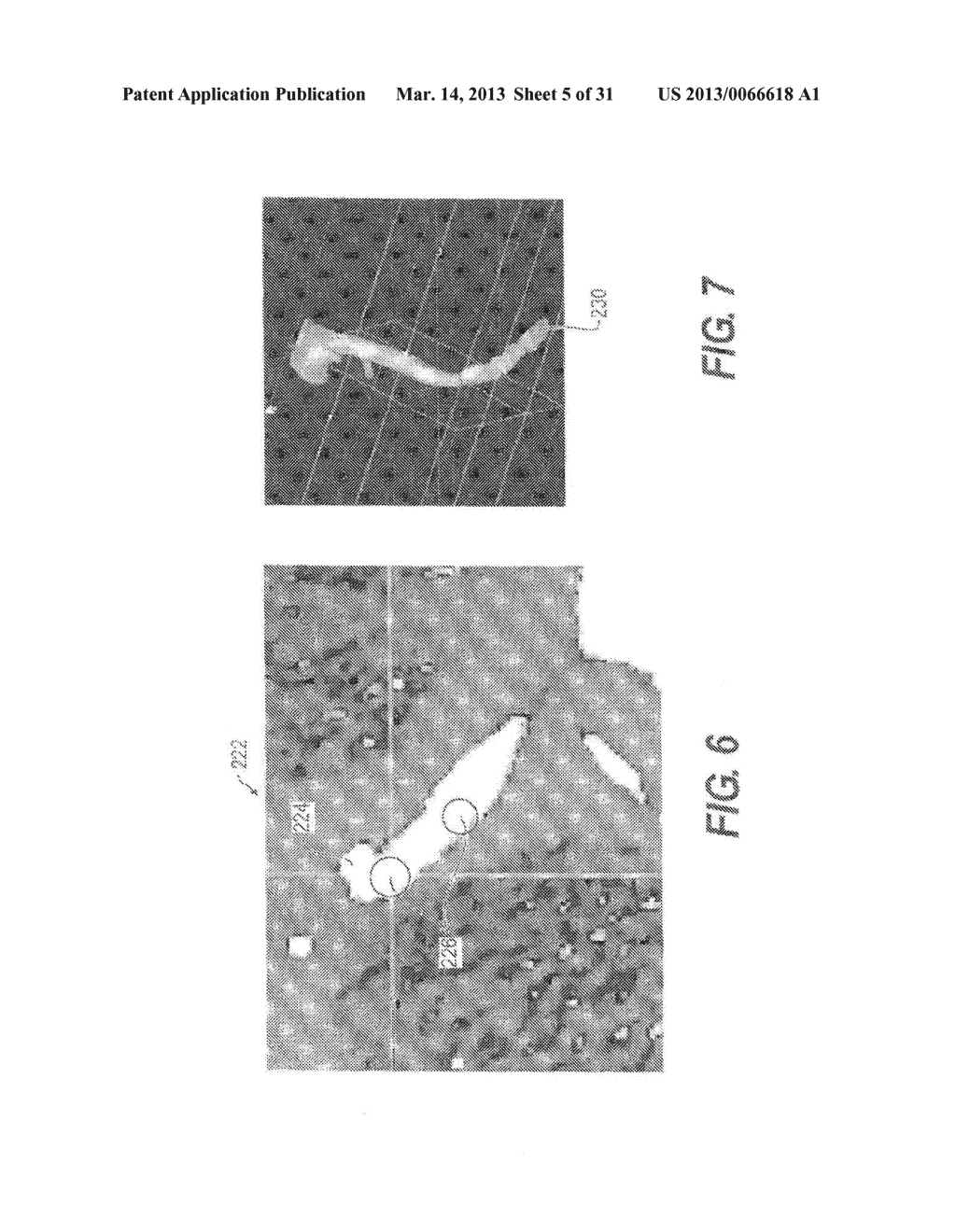 METHOD AND SYSTEM FOR PATIENT-SPECIFIC MODELING OF BLOOD FLOW - diagram, schematic, and image 06