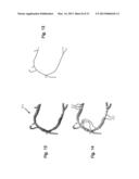 METHOD AND SYSTEM FOR PATIENT-SPECIFIC MODELING OF BLOOD FLOW diagram and image