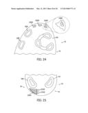 Cut Step Traction Element Arrangement For An Article Of Footwear diagram and image