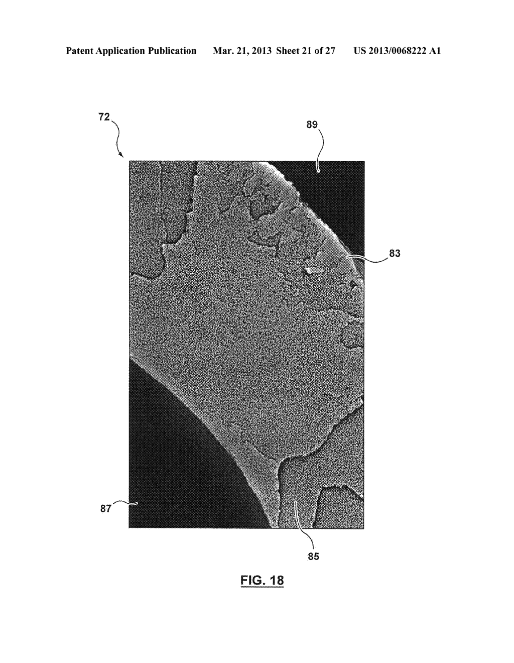 ANESTHETIC CIRCUIT AND A METHOD FOR USING THE ANESTHETIC CIRCUIT - diagram, schematic, and image 22