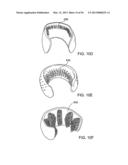 TONGUE RETAINING ORAL APPLIANCE diagram and image