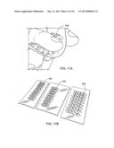 TONGUE RETAINING ORAL APPLIANCE diagram and image