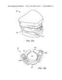 TONGUE RETAINING ORAL APPLIANCE diagram and image