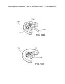 TONGUE RETAINING ORAL APPLIANCE diagram and image