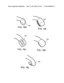 TONGUE RETAINING ORAL APPLIANCE diagram and image