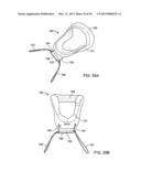 TONGUE RETAINING ORAL APPLIANCE diagram and image