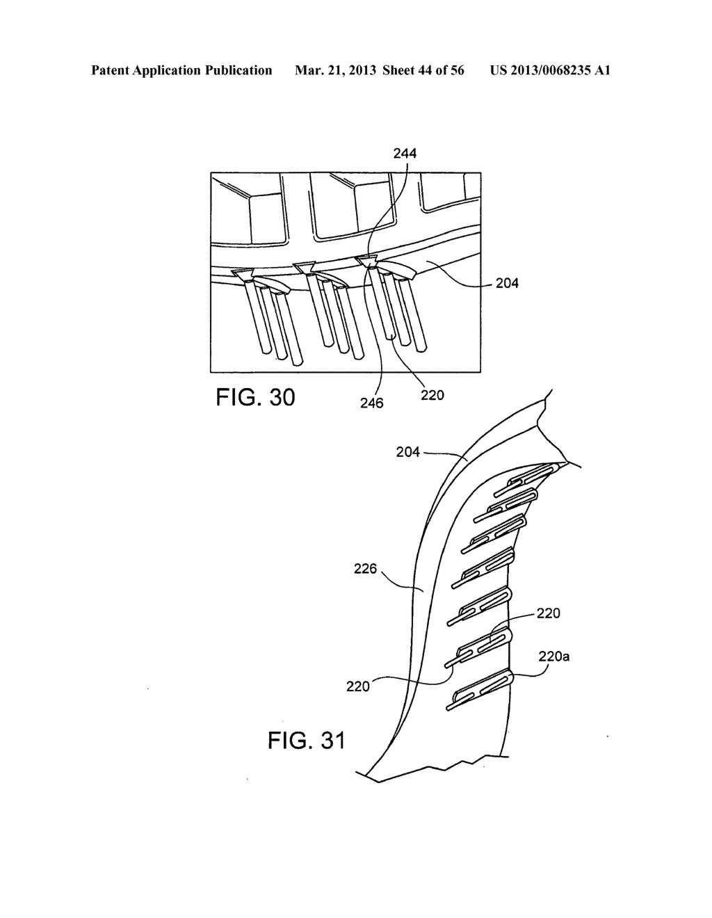 TONGUE RETAINING ORAL APPLIANCE - diagram, schematic, and image 45