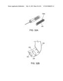 TONGUE RETAINING ORAL APPLIANCE diagram and image