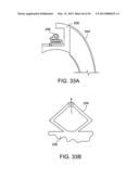 TONGUE RETAINING ORAL APPLIANCE diagram and image