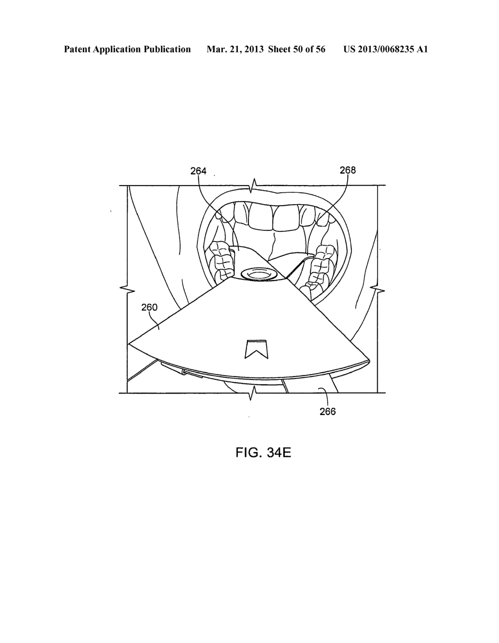 TONGUE RETAINING ORAL APPLIANCE - diagram, schematic, and image 51